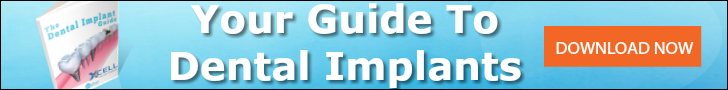 access to dental implant guide